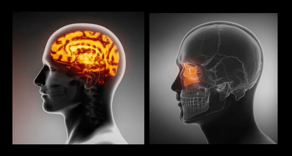 Scientists Develop AI Algorithms To Analyze Enormous Datasets In Alzheimer's Research